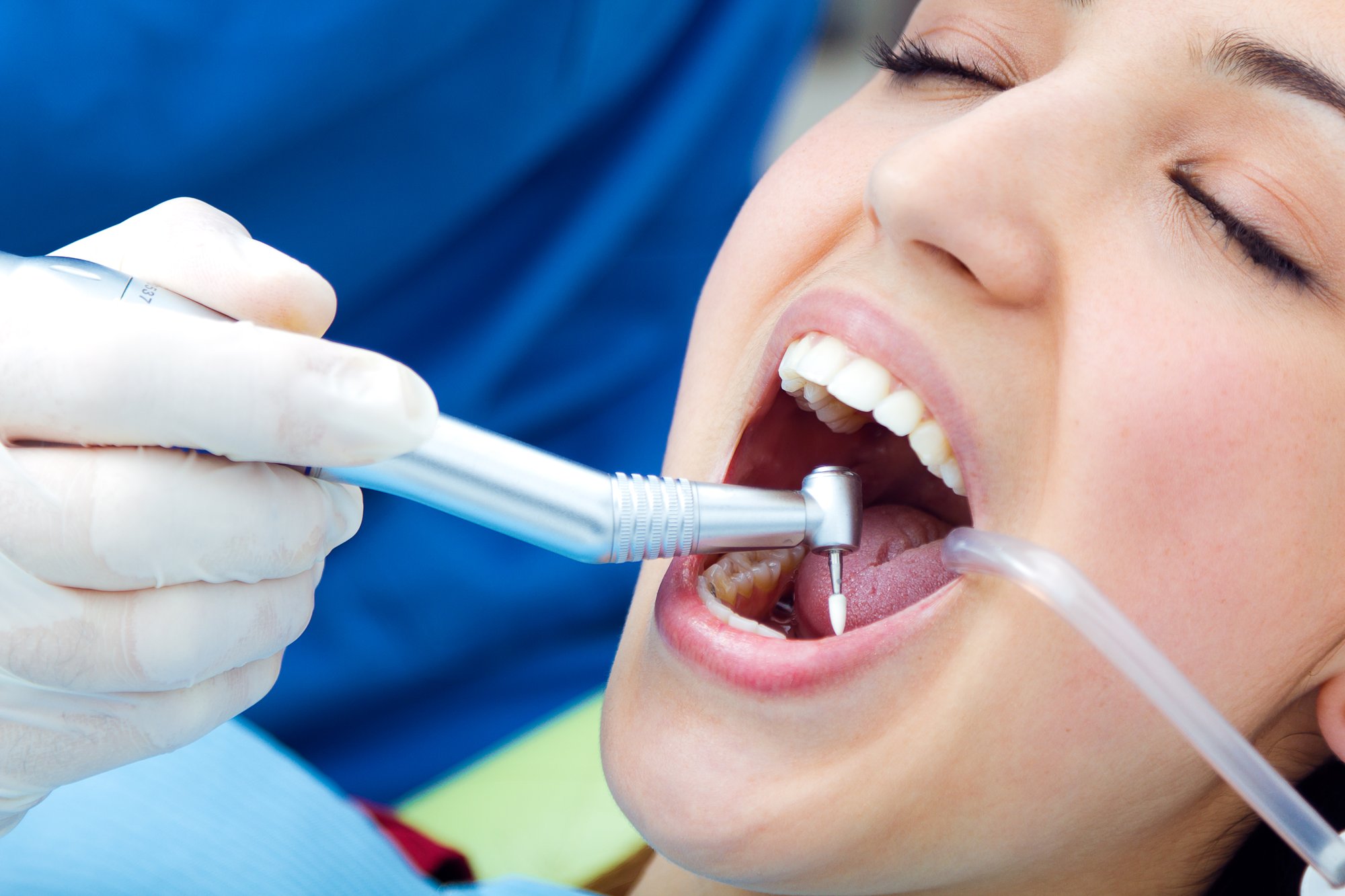 checkup-dentist-tool-instrument-young checkup-dentist-tool-instrument-young